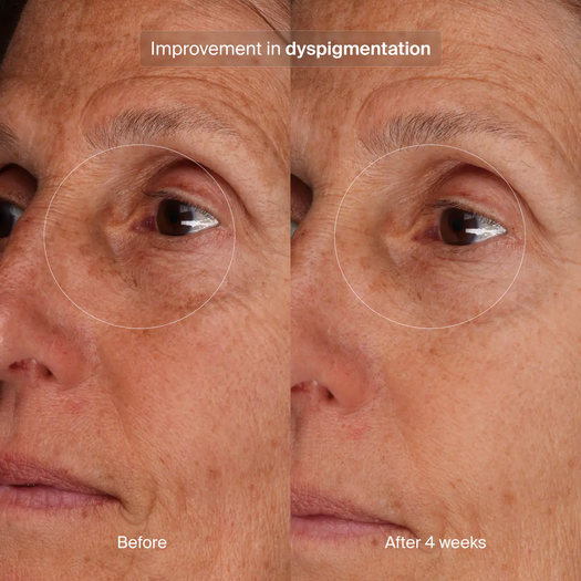 Bioadaptive Stress Repair Refill
