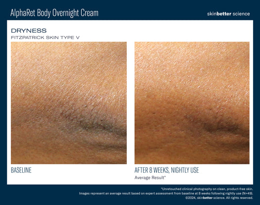 AlphaRet Body Overnight Cream TRAVEL SIZE
