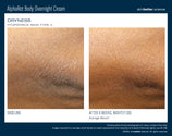 Load image into Gallery viewer, AlphaRet Body Overnight Cream TRAVEL SIZE