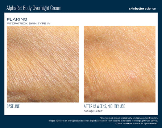 AlphaRet Body Overnight Cream TRAVEL SIZE