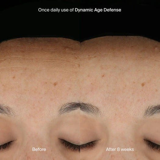Dynamic Age Defense Refill