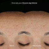 Load image into Gallery viewer, Dynamic Age Defense Refill