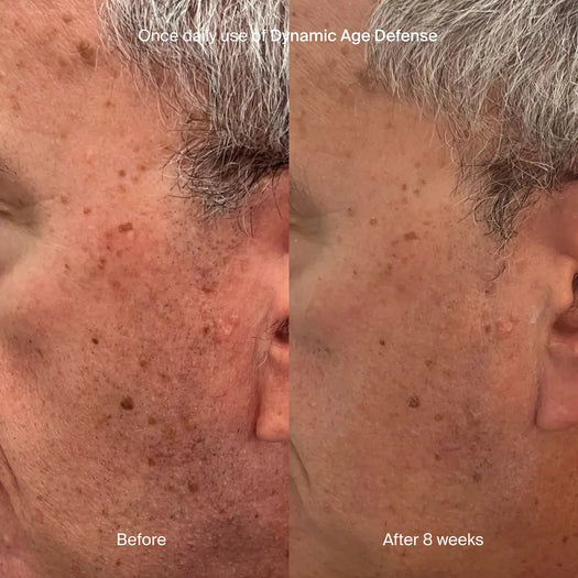 Dynamic Age Defense Refill