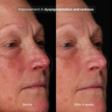 Load image into Gallery viewer, Bioadaptive Stress Repair Refill