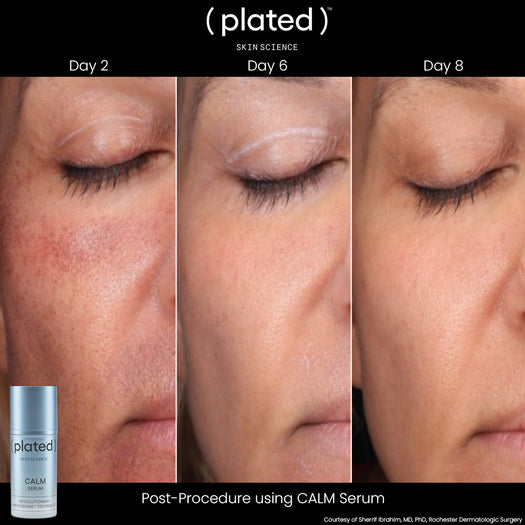 ( plated )™ CALM Serum