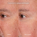 Load image into Gallery viewer, Precision Eye Lift