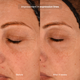 Load image into Gallery viewer, Precision Eye Lift