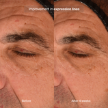 Load image into Gallery viewer, Precision Eye Lift