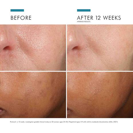 Phloretin CF with Ferulic Acid