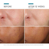Load image into Gallery viewer, Phloretin CF with Ferulic Acid