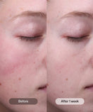 Load image into Gallery viewer, Radiance+ Resurfacing Serum