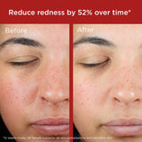 Load image into Gallery viewer, EltaMD UV Skin Recovery Broad Spectrum SPF 50 Face Sunscreen