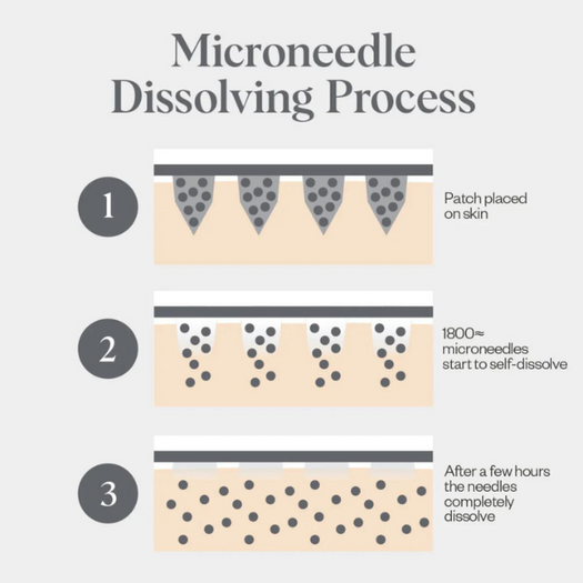 Self-Dissolving Microneedle Patches - 8 Patches