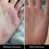 Load image into Gallery viewer, Omnilux Contour Glove
