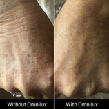 Load image into Gallery viewer, Omnilux Contour Glove