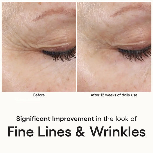 ( plated ) INTENSE Serum