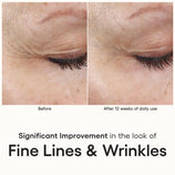 Load image into Gallery viewer, ( plated ) INTENSE Serum