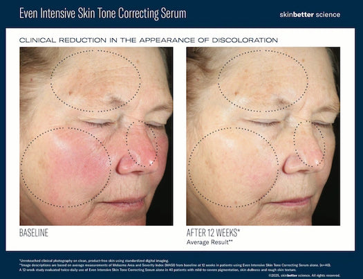 Even Intensive Skin Tone Correcting Serum – Prischmann Skin