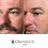 Load image into Gallery viewer, *NEW* Omnilux Men